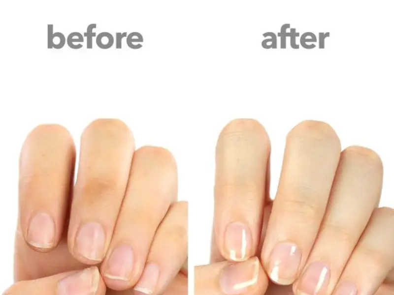 Tips for Healthy Nails After Removal